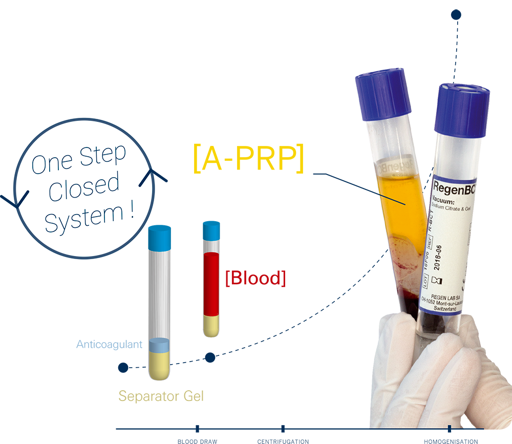 Qu'est ce que le PRP (Plasma